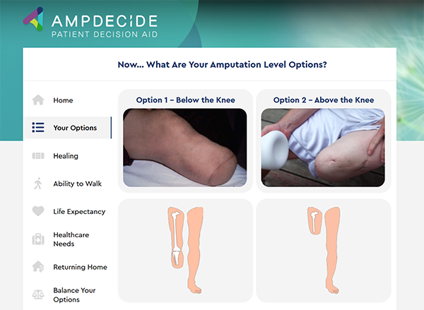 The image shows two bar graphs comparing the chance of having healing problems and needing additional amputation surgery within one year of amputation for two different types of amputations: "Across the Foot" and "Below the Knee." The first graph, labeled "Across the Foot," indicates that on average 40 out of 100 patients need additional surgery. The second graph, labeled "Below the Knee," indicates that on average 26 out of 100 patients need additional surgery. Each graph uses icons representing people to visually depict these statistics.