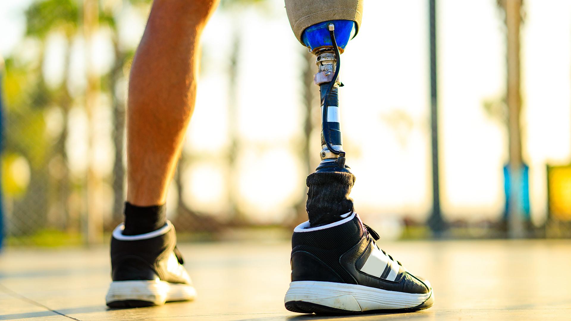 A detail of a person in shorts with a prosthetic right leg.